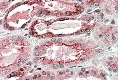 Anti-GGCX antibody, C-term used in IHC (Paraffin sections) (IHC-P). GTX88337