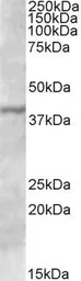 Anti-TFB1M antibody, C-term used in Western Blot (WB). GTX88340