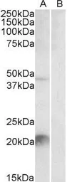 Anti-Kallikrein 6 antibody, C-term used in Western Blot (WB). GTX88341