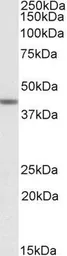 Anti-TAF7L antibody, Internal used in Western Blot (WB). GTX88345