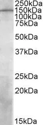 Anti-PREX1 antibody, Internal used in Western Blot (WB). GTX88346