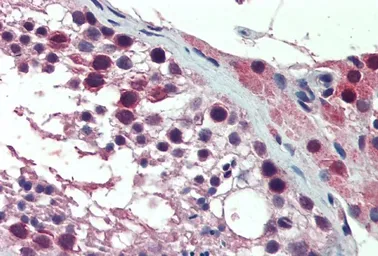 Anti-PREX1 antibody, Internal used in IHC (Paraffin sections) (IHC-P). GTX88346