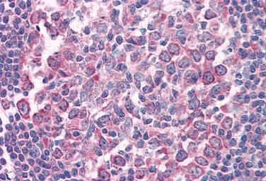 Anti-Fas antibody, Internal used in IHC (Paraffin sections) (IHC-P). GTX88349