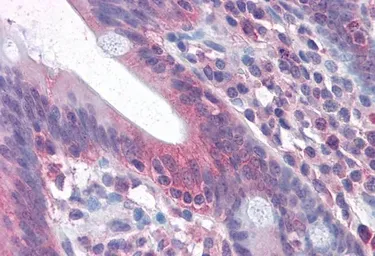 Anti-Fas antibody, Internal used in IHC (Paraffin sections) (IHC-P). GTX88349