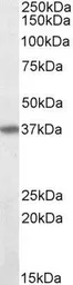 Anti-Fas antibody, Internal used in Western Blot (WB). GTX88349