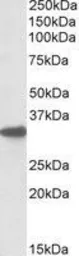 Anti-CYB5R3 antibody, C-term used in Western Blot (WB). GTX88352