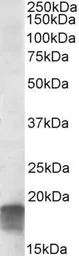 Anti-SDHAF1 antibody, C-term used in Western Blot (WB). GTX88354