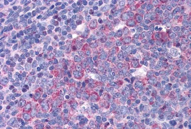 Anti-eIF5A antibody, Internal (near N-term) used in IHC (Paraffin sections) (IHC-P). GTX88355
