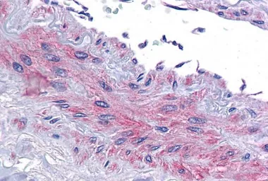 Anti-eIF5A antibody, Internal (near N-term) used in IHC (Paraffin sections) (IHC-P). GTX88355