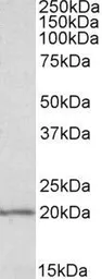 Anti-eIF5A antibody, Internal (near N-term) used in Western Blot (WB). GTX88355
