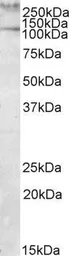 Anti-Talin-1 antibody, Internal used in Western Blot (WB). GTX88357