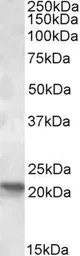 Anti-POLR2G antibody, Internal used in Western Blot (WB). GTX88361