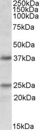 Anti-Podoplanin antibody, Internal used in Western Blot (WB). GTX88363