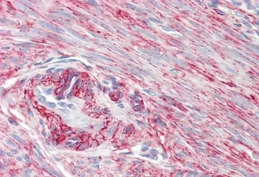 Anti-PRKCDBP antibody, Internal used in IHC (Paraffin sections) (IHC-P). GTX88367