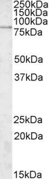 Anti-SGSM3 antibody, Internal used in Western Blot (WB). GTX88368