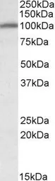 Anti-Calnexin antibody, Internal (near N-term) used in Western Blot (WB). GTX88369