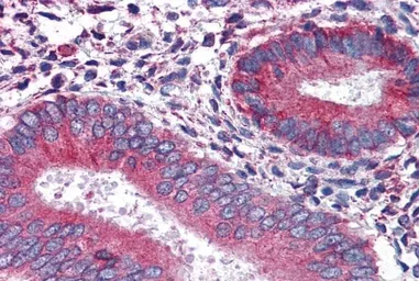 Anti-Calnexin antibody, Internal (near N-term) used in IHC (Paraffin sections) (IHC-P). GTX88369