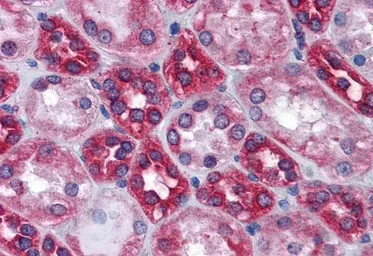 Anti-Calnexin antibody, Internal (near N-term) used in IHC (Paraffin sections) (IHC-P). GTX88369