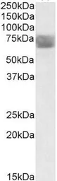 Anti-TPP1 antibody, Internal used in Western Blot (WB). GTX88372