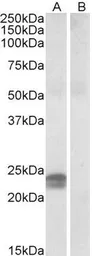 Anti-HMGA1 (aa9-21) antibody, Internal (near N-term) used in Western Blot (WB). GTX88373