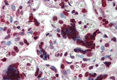 Anti-HMGA1 (aa9-21) antibody, Internal (near N-term) used in IHC (Paraffin sections) (IHC-P). GTX88373