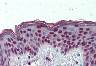 Anti-HMGA1 (aa9-21) antibody, Internal (near N-term) used in IHC (Paraffin sections) (IHC-P). GTX88373