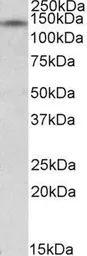 Anti-RIP140 antibody, Internal used in Western Blot (WB). GTX88376