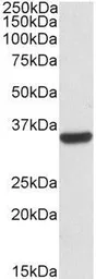 Anti-Calponin 2 antibody, Internal used in Western Blot (WB). GTX88377