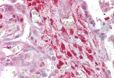 Anti-Calponin 2 antibody, Internal used in IHC (Paraffin sections) (IHC-P). GTX88377