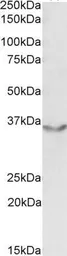 Anti-JAM-B antibody, Internal used in Western Blot (WB). GTX88378