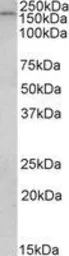 Anti-CLIP170 antibody, C-term used in Western Blot (WB). GTX88382