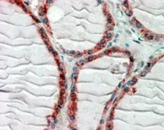 Anti-CLIP170 antibody, C-term used in IHC (Paraffin sections) (IHC-P). GTX88382