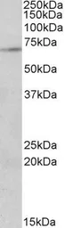 Anti-PRMT5 antibody, Internal used in Western Blot (WB). GTX88383