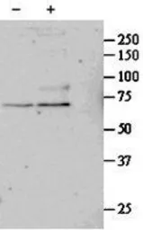 Anti-SRF antibody, Internal used in Western Blot (WB). GTX88384