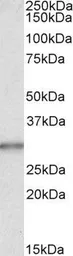 Anti-Carbonic Anhydrase 1 antibody, Internal used in Western Blot (WB). GTX88385