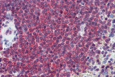 Anti-Carbonic Anhydrase 1 antibody, Internal used in IHC (Paraffin sections) (IHC-P). GTX88385