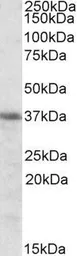 Anti-Heme Oxygenase 2 antibody, Internal used in Western Blot (WB). GTX88386