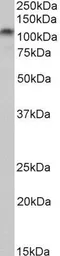 Anti-PSD95 antibody, Internal (near C-Terminus) used in Western Blot (WB). GTX88388