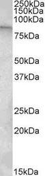Anti-TRPC4AP antibody, Internal used in Western Blot (WB). GTX88389