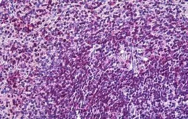 Anti-CD11a antibody, Internal used in IHC (Paraffin sections) (IHC-P). GTX88390