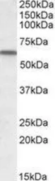 Anti-Vitamin D Binding Protein antibody, Internal (near the N-term) used in Western Blot (WB). GTX88396