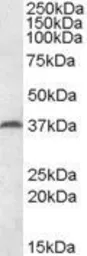 Anti-MEST antibody, Internal used in Western Blot (WB). GTX88397