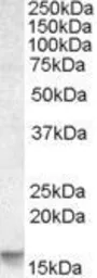 Anti-Noxa antibody, Internal used in Western Blot (WB). GTX88398