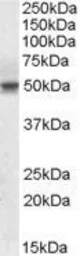 Anti-SEPT6 antibody, Internal used in Western Blot (WB). GTX88399