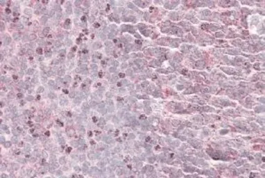 Anti-SEPT6 antibody, Internal used in IHC (Paraffin sections) (IHC-P). GTX88399