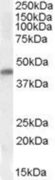 Anti-Nkx2.5 antibody, Internal used in Western Blot (WB). GTX88402