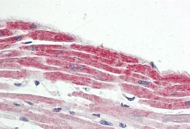 Anti-Nkx2.5 antibody, Internal used in IHC (Paraffin sections) (IHC-P). GTX88402