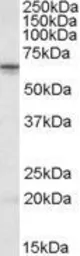 Anti-STK39 antibody, Internal used in Western Blot (WB). GTX88403
