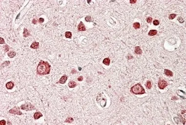 Anti-STK39 antibody, Internal used in IHC (Paraffin sections) (IHC-P). GTX88403