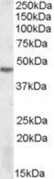 Anti-DRAK2 antibody, Internal used in Western Blot (WB). GTX88405